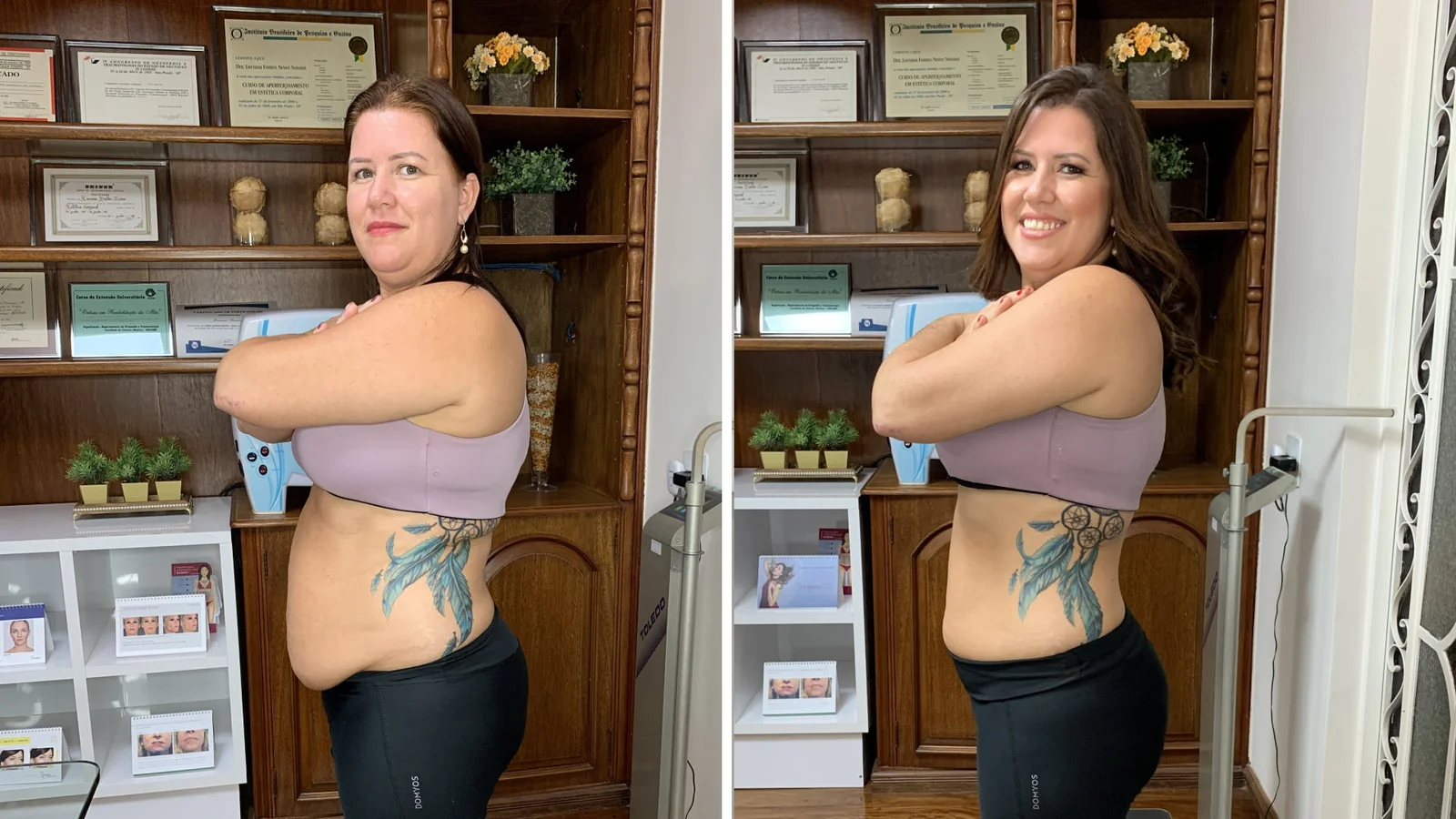 Sandra before and after